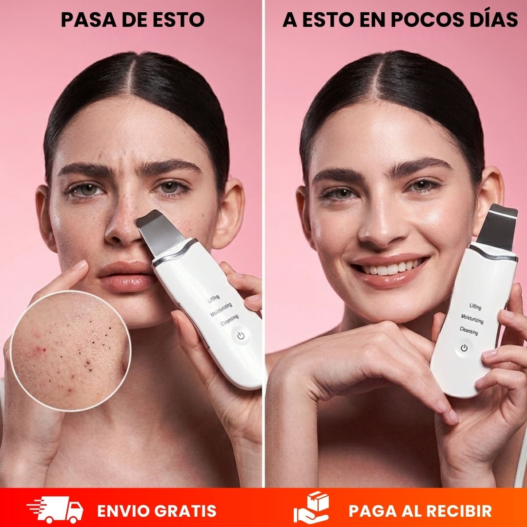 GlowLift™-Elimina impurezas y revive tu brillo